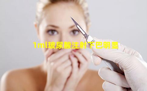 1ml玻尿酸注射下巴明显