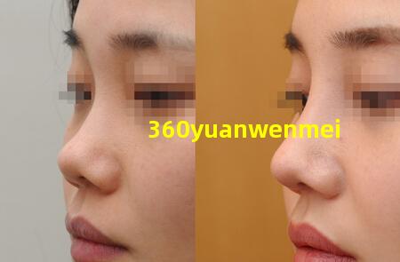 360元纹眉