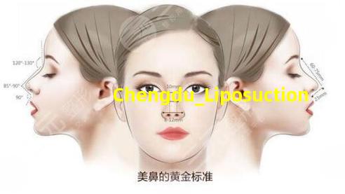 成都抽脂手术图片