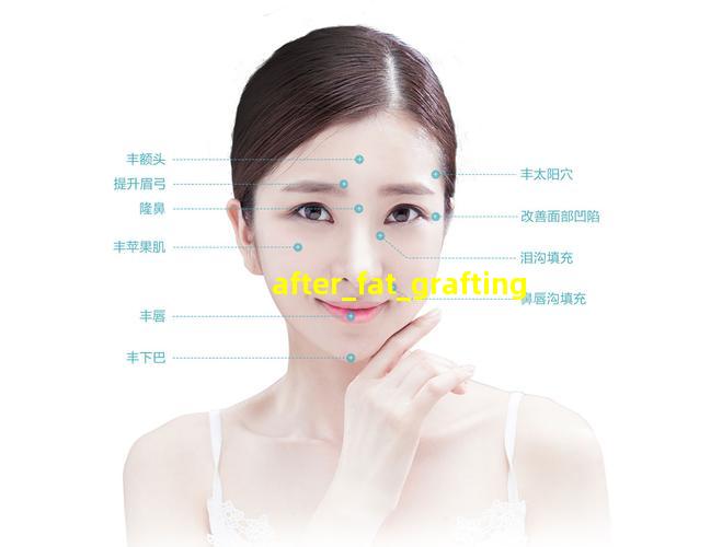 自体脂肪丰脸术后图片
