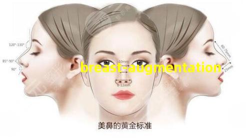 Breast Augmentation