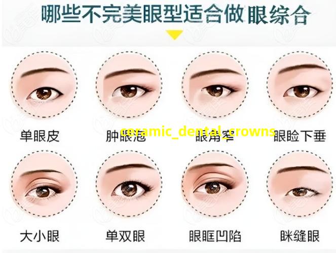 全瓷牙修复效果图