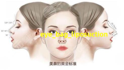 眼袋抽脂术