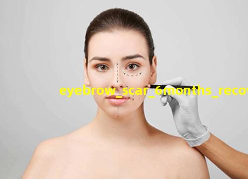 眉骨疤痕6个月恢复图片
