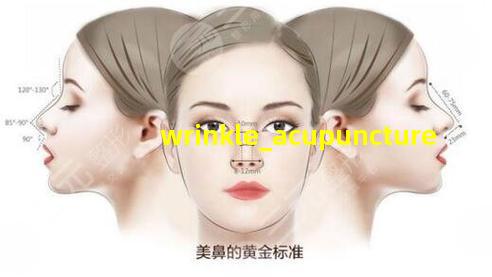 针灸治疗