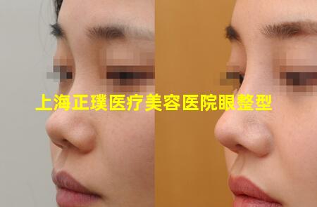 上海正璞医疗美容医院眼整型