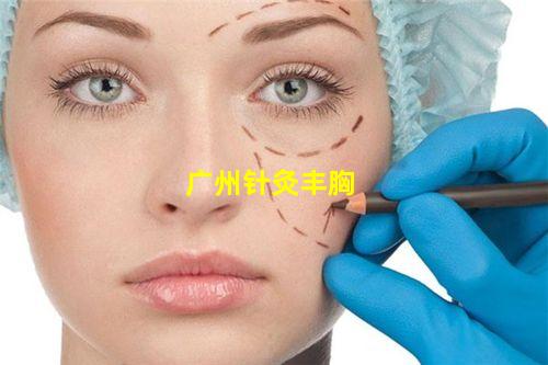 广州针灸丰胸