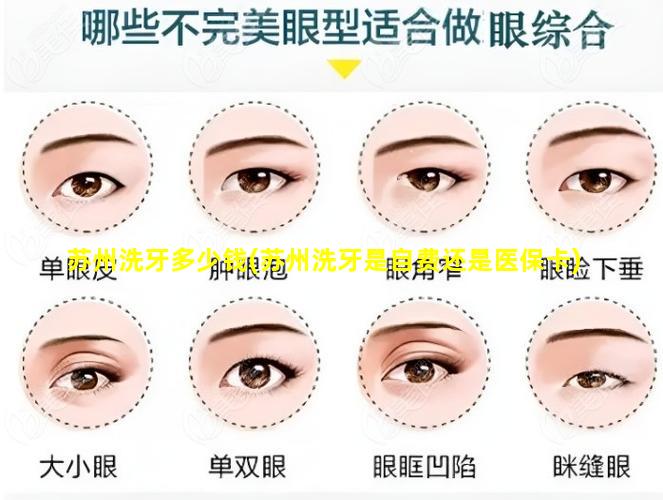 苏州洗牙多少钱(苏州洗牙是自费还是医保卡)