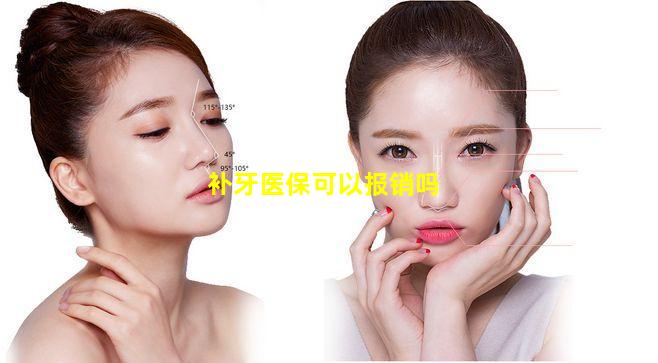 补牙医保可以报销吗