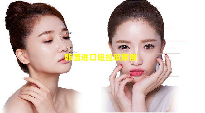 韩国进口纽拉玻尿酸