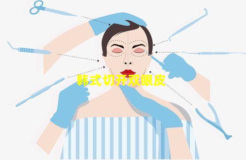 韩式切开双眼皮